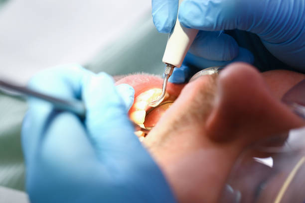 Best Emergency Denture Repair in Monsey, NY