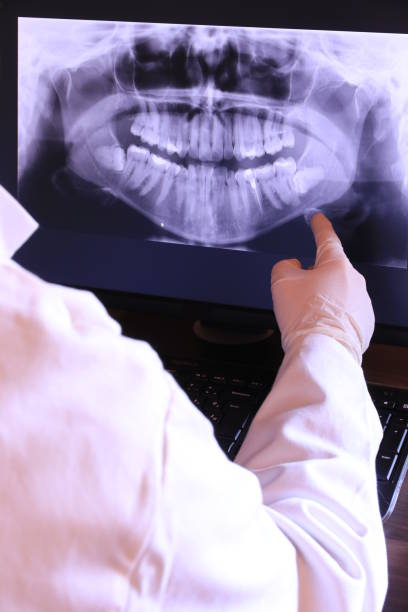 Best Emergency Tooth Extraction in Monsey, NY