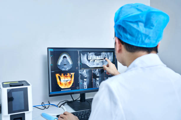 Best Emergency Wisdom Teeth Removal in Monsey, NY